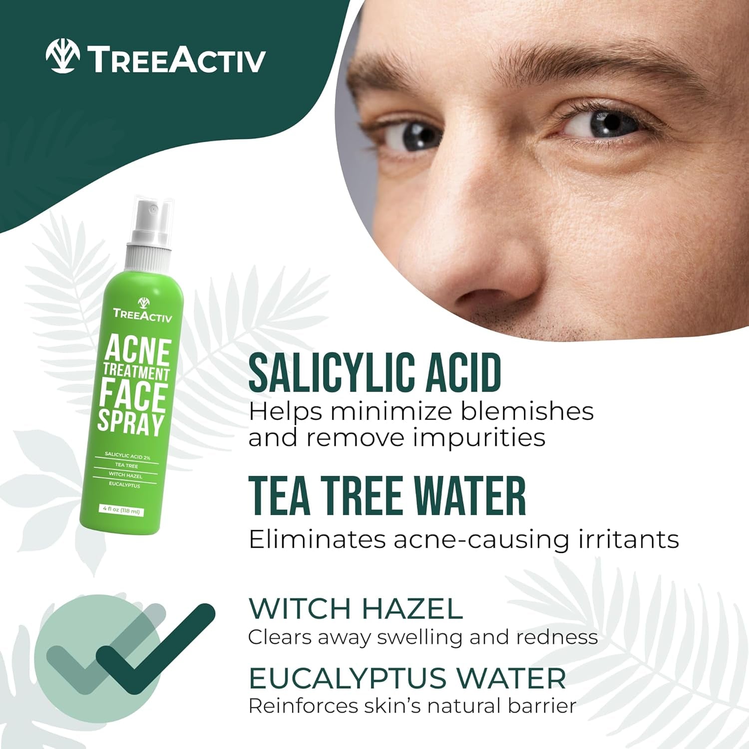 Acne Treatment Face Spray, 4 Fl Oz Facial Spray with Witch Hazel, Salicylic Acid for Acne Prone and Oily Skin, for Hormonal, Severe Cystic Acne, Skin Clearing Toner, 1000 Sprays