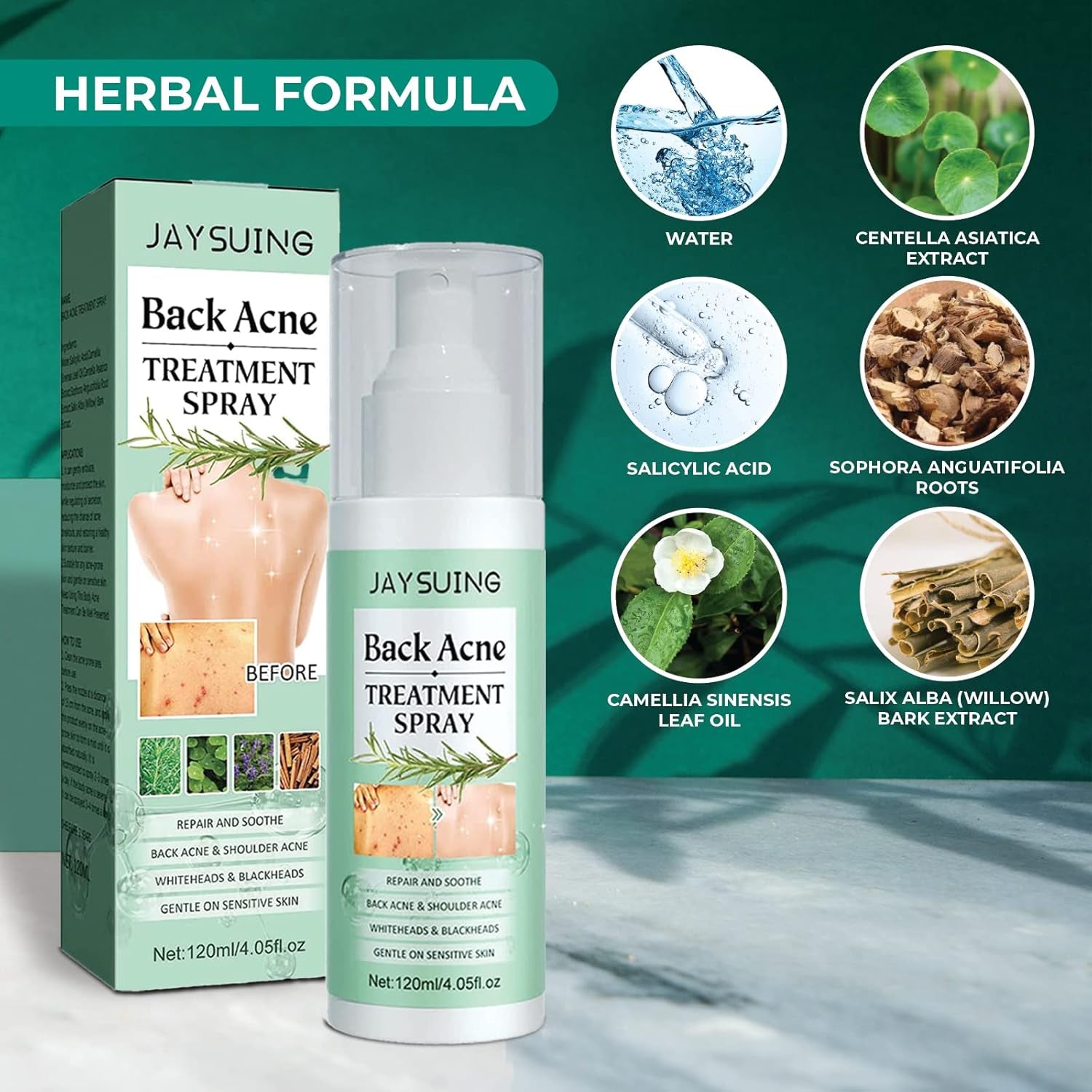 3 Pack Back Acne Treatment, Back Acne Spray, 2% Salicylic Acid Spray, Body Acne Treatment with Herbal Formula, Body Acne Spray, Tea Tree Oil Spray, Acne Treatment for Teens, Back Acne Solution