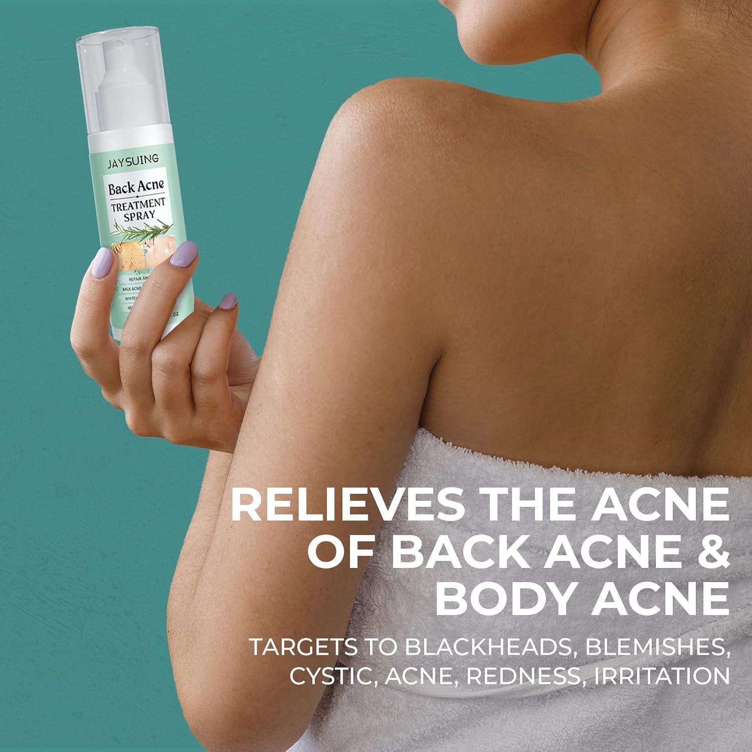 3 Pack Back Acne Treatment, Back Acne Spray, 2% Salicylic Acid Spray, Body Acne Treatment with Herbal Formula, Body Acne Spray, Tea Tree Oil Spray, Acne Treatment for Teens, Back Acne Solution